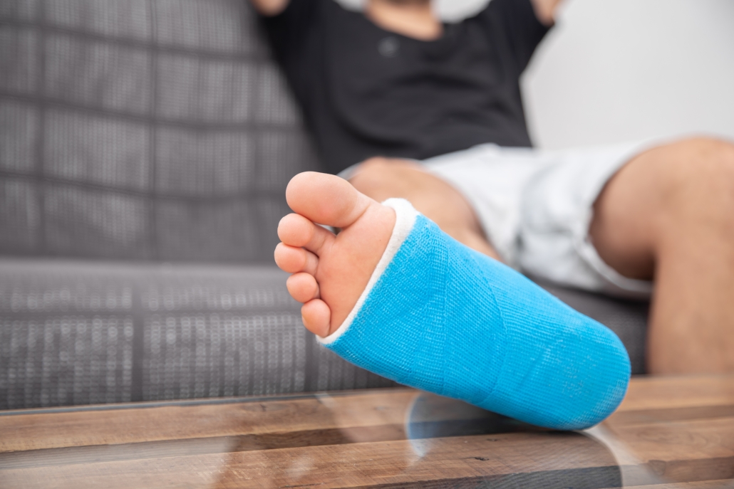 Man with broken leg in cast on couch at home. Proverbs 25:19 says like a broken tooth or lame is relying on the unfaithful